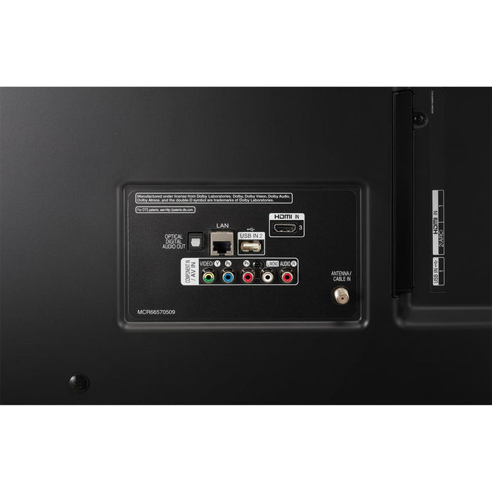 LG 75" HDR 4K UHD Smart IPS LED TV 2019 Model + Soundbar Bundle